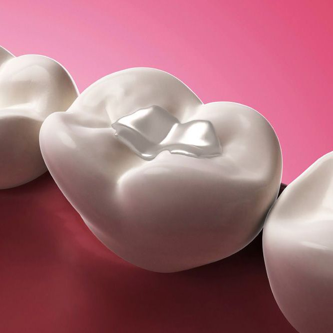 Fillings