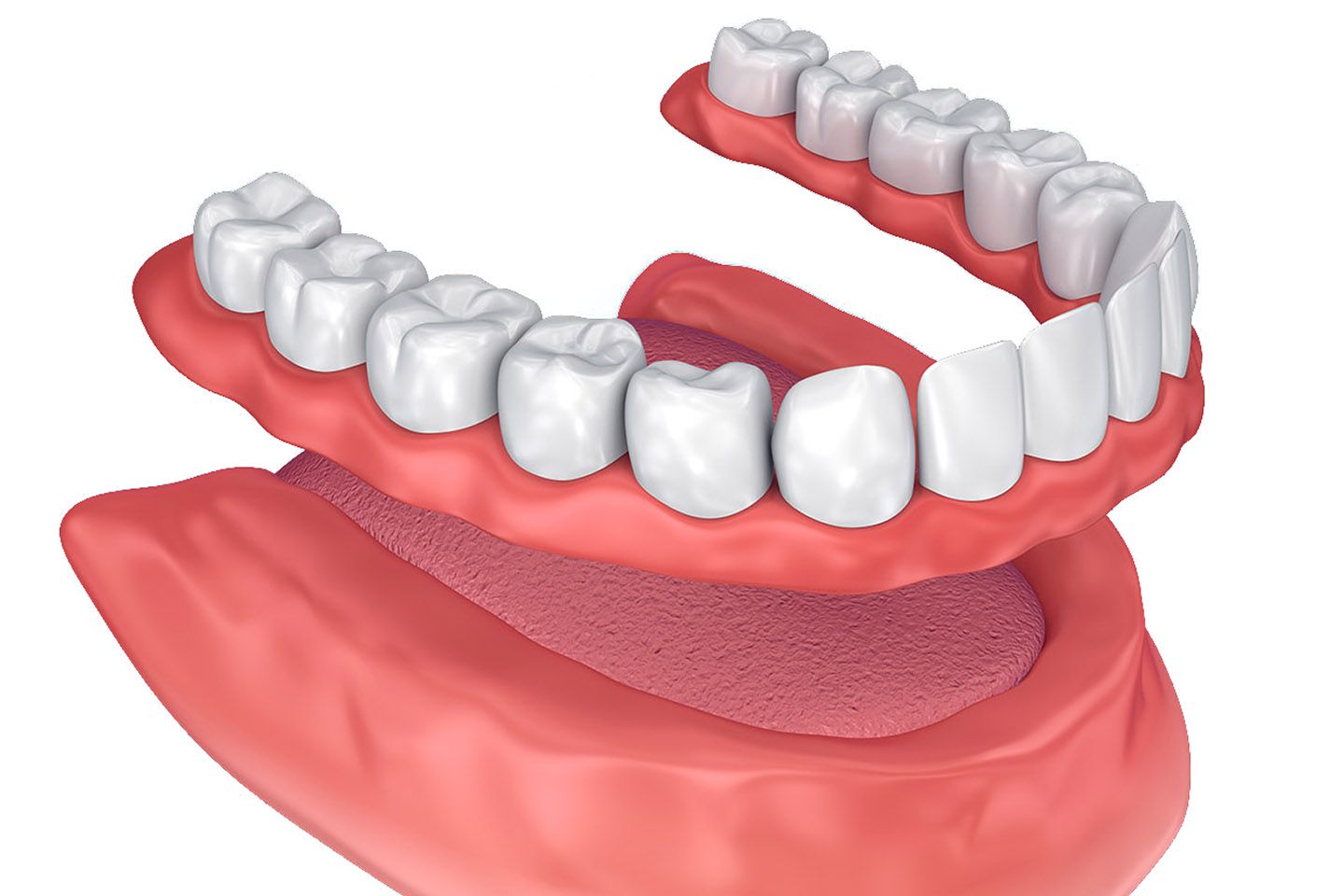 Dentures